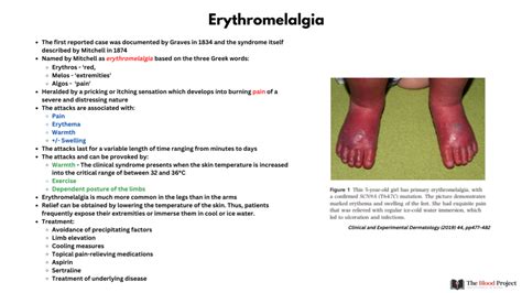 erythromelalgia pictures|is erythromelalgia deadly.